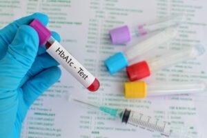 Read more about the article Prediabetes Symptoms: Early Warning Signs, Causes, Tests & Prevention
