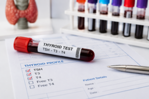 Read more about the article Thyroid Test: TSH, T3 & T4 Normal Range Explained